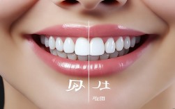 2025年隐形矫正器真的有用吗？