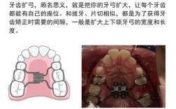 矫正牙齿时，专业话术对缓解焦虑、提升配合度和效果有何作用？