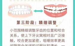 正畸中2火4技术具体指什么？