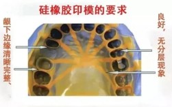 硅橡胶改良取模方法较传统方法在精准度与效率上有何显著优势？