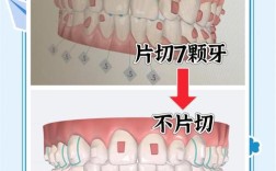 下切牙磕掉了想正畸
