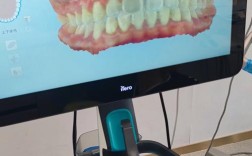 如何通过口腔扫描仪使用方法视频掌握正确操作步骤？