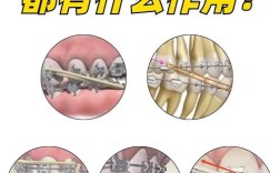 正畸吊扎方法的具体操作步骤、技巧及注意事项是怎样的？