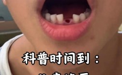 小孩子能植牙吗