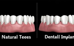 2025牙齿修复，假牙和种植牙到底有何不同？