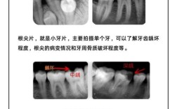 牙齿正畸拍片为何必要？包含哪些关键检查？