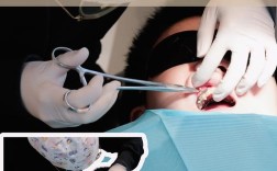 正畸治疗肌体反应