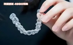 东莞牙齿矫正哪家好？求推荐技术好又价格合理的机构！