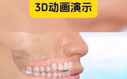 前牙开颌如何有效治疗？方法有哪些？