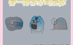 正畸期间嵌体修复可行吗？需注意哪些问题？