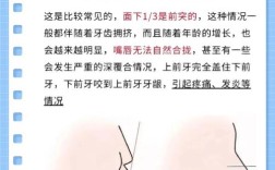 正畸拔牙会改变脸型吗