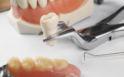 有陶瓷牙可以矫正牙齿