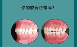 正畸治疗中，咬合关系具体可以分为哪几种类型？