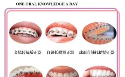 牙齿矫正器怎么摘？不同矫正器的摘取步骤有何不同？