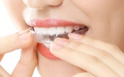 佳德口腔矫正牙齿效果好吗？适合哪些人？