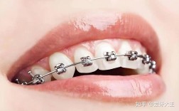 广州舌侧正畸形价格