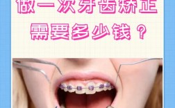 矫正牙齿费用必须一次性付清吗？