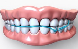 2025矫正牙齿皮筋怎么带？新手必看操作指南