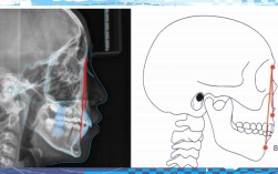 正畸anb角的正常值范围是多少？