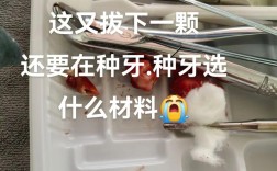 种牙常用哪些材质？安全耐用怎么选？