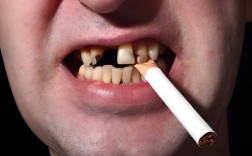种牙能吸烟么