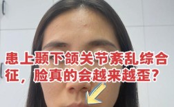 正畸后为何会出现颞颌关节紊乱问题？
