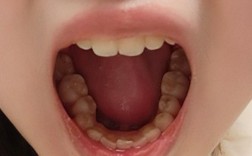 正畸之后牙弓歪了