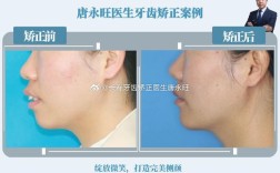 主治医师矫正进修一年半，技能提升效果如何？