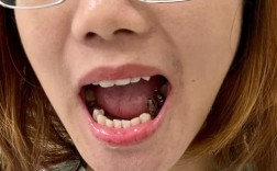 种牙不成功会有哪些异常表现？