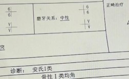 正畸诊断名称通常有哪些具体分类？