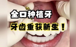 北京种植牙哪家好？价格、效果、流程怎么权衡？