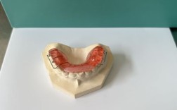 正畸牙齿上为何要加弹簧？作用原理是什么？