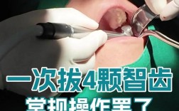 智齿拔牙怎样才算快速？有哪些安全高效的操作方法和技巧？