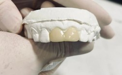 临时冠能支撑正畸