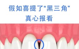 牙齿正畸黑三角的原因