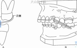 正畸支抗植入方法的选择与应用如何规范？