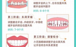 牙齿矫正的具体步骤是怎样的？详细流程有哪些？