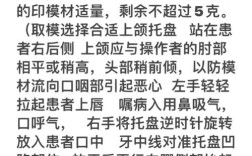 功能性印模制取方法图中的关键操作如何通过图示理解？