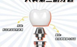 哪种种牙系统种牙速度更快？