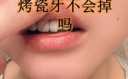 烤瓷牙能用来矫正牙齿吗？