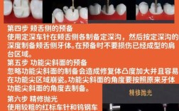 确定牙体预备量的方法有