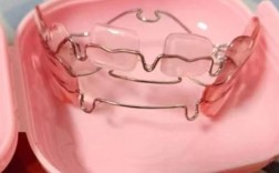 正畸儿童早期矫正