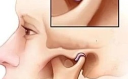 正畸过程中下巴为何脱位？原因、处理及预防建议