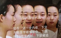 拜博口腔牙齿综合正畸效果真的靠谱吗？不同牙齿问题矫正周期差异大吗？价格透明吗？医生会根据个人情况定制方案吗？