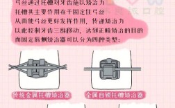 金属托槽夹取如何做到精准高效？关键方法与操作技巧全解析