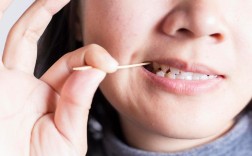 种完牙吃东西总塞牙，是种植体不贴合吗？