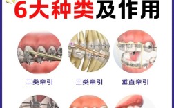 正畸和平面的控制