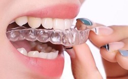 隐形矫正牙齿的具体矫正过程是怎样的？