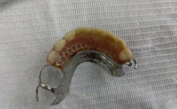 种牙vs活动义齿，到底哪个更适合？