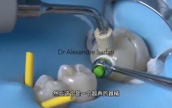 树脂嵌体粘接方法的关键步骤有哪些？